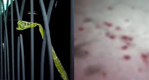 სისხლიანი გარჩევა თბილისში: "სკვერში" კაცი დაჭრეს - "სიტყვიერი შელაპარაკება მოხდა, რაც ფიზიკურ დაპირისპირებაში გადაიზარდა"