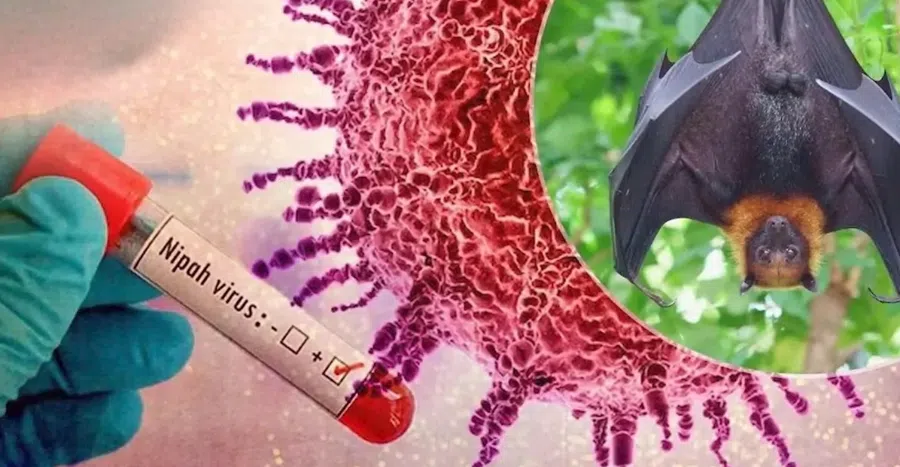 ნიპას ვირუსი: 2026 წელს მსოფლიოში ერთ-ერთ ყველაზე აგრესიულ პათოგენი
