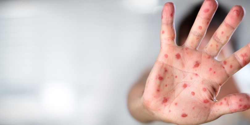 "წითელას" აფეთქებამ სულ მცირე 28 ადამიანი იმსხვერპლა"